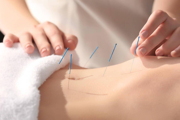 Abdominal acupuncture