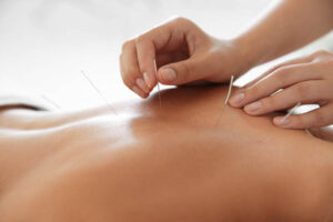 acupuncture clinic Vancouver